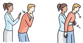 Heimlich maneuever