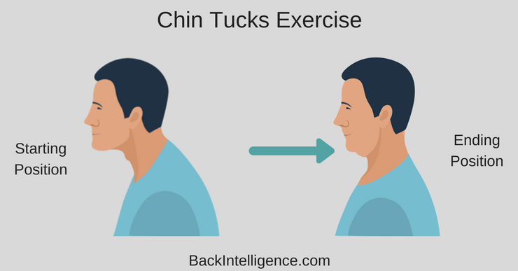 chin tuck