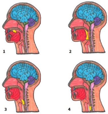 Figure 1. Swallowing mechanism